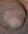 plasto61's Avatar