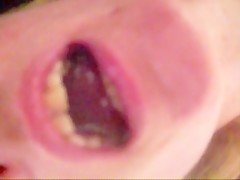Thumb 10